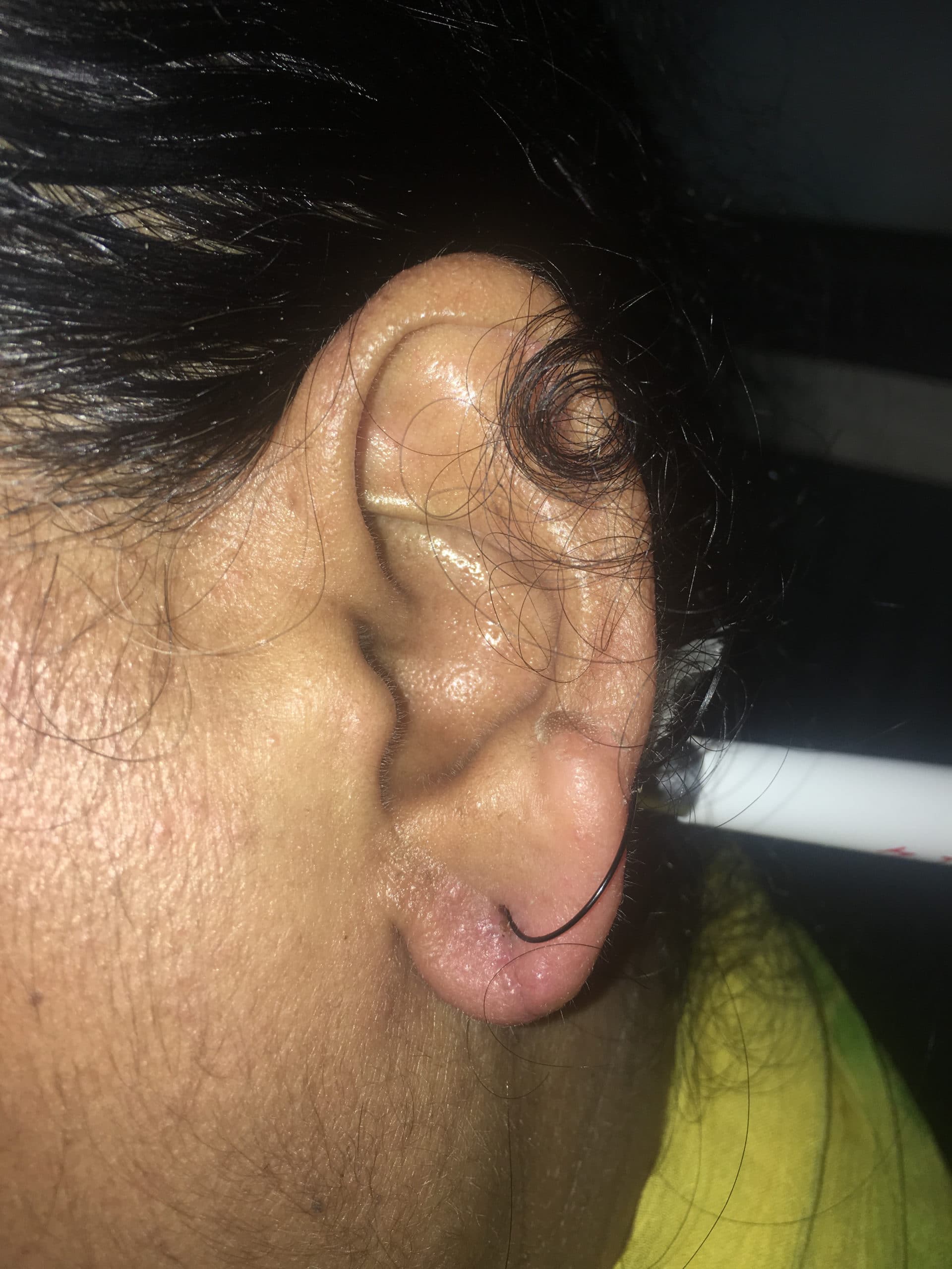 earrepairbefore treatment clinic in india