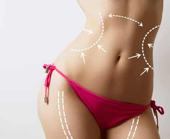 affordable & Low Cost liposuction surhery in Hyderabad 