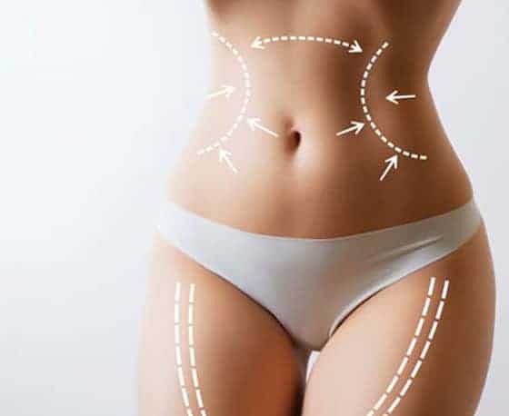 surgical liposuction  services at affordable cost