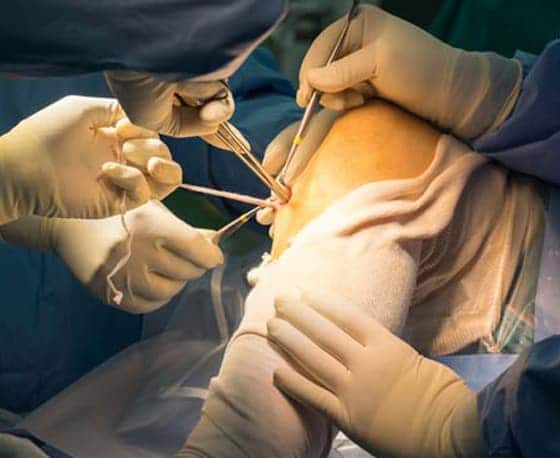 leg reconstruction surgery in hyderabad