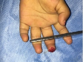 hand surgery clinic