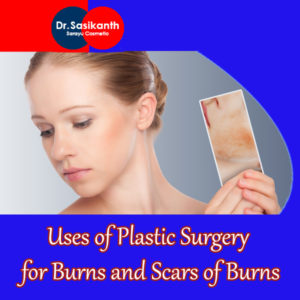 Uses of plastic surgery for burns and scars of burns - Best Cosmetic ...