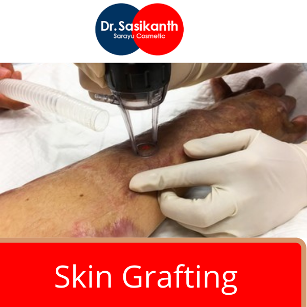 skin grafting procedure in hyderabad